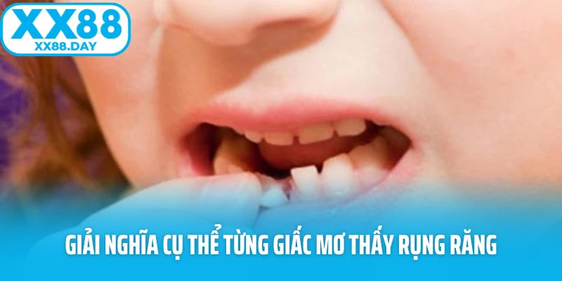 Giải nghĩa cụ thể từng giấc mơ thấy rụng răng